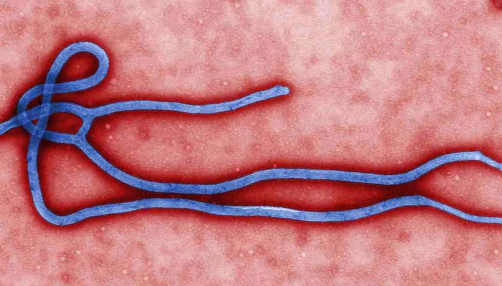 A micrograph of the Ebola virus. (Centers for Disease Control and Prevention)