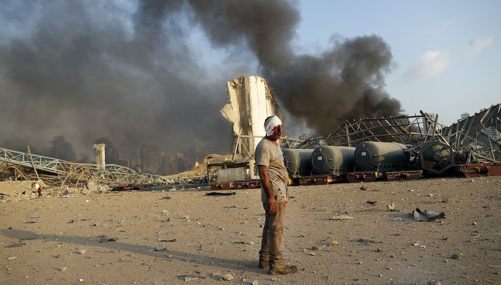 An injured man waits for help at the explosion scene that hit the seaport of Beirut, Lebanon. (AP Photo/Hussein Malla)